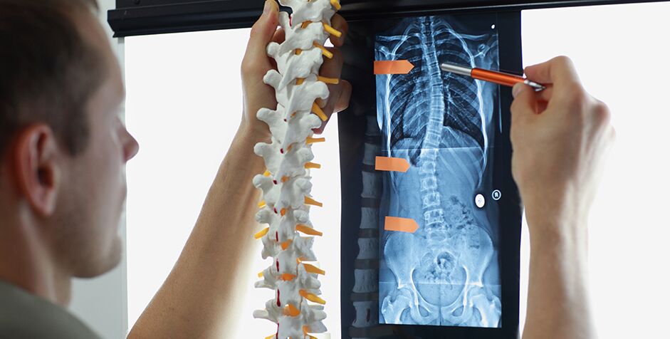 Spinal Cord Injury Pittsburgh Spine Injury Lawyers